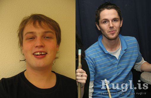 tyrfill vs pulli